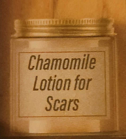 Chamomile Scar Lotion 2oz.